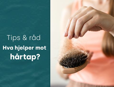 Hva hjelper mot hårtap?